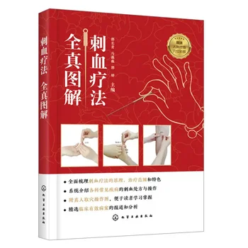 Полная картина терапии уколами Крови, Книга по терапии Уколами Крови, Полная книга по терапии уколами Крови В Китае